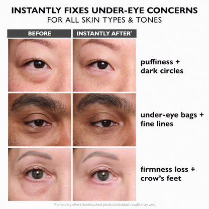 🌸Yoooohub Eye Fix – Instant Puffiness Reducer & Brightening Cream🔥
