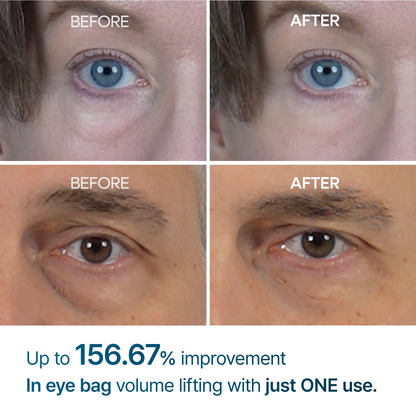 🌸Yoooohub Eye Fix – Instant Puffiness Reducer & Brightening Cream🔥